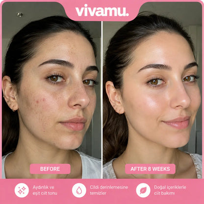 Vivamu™ Kojik Asit & Zerdeçal Yüz Temizleme Pedi – 40 Adet