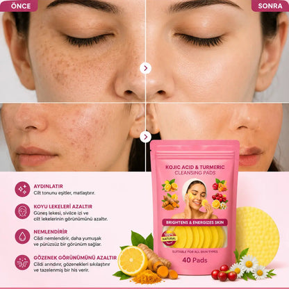 Vivamu™ Kojik Asit & Zerdeçal Yüz Temizleme Pedi – 40 Adet